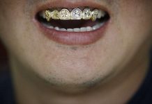 Jeweler on the Grill for Alleged Dental Work Without License