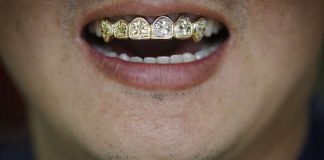 Jeweler on the Grill for Alleged Dental Work Without License