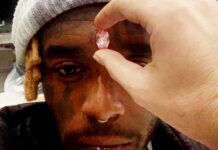 Rapper has $24m Pink Diamond Embedded in his Forehead