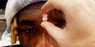 Rapper has $24m Pink Diamond Embedded in his Forehead