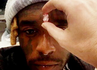 Rapper has $24m Pink Diamond Embedded in his Forehead