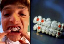 Rapper Wears $50,000 Diamonds on His Teeth