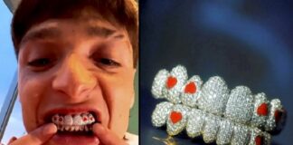 Rapper Wears $50,000 Diamonds on His Teeth